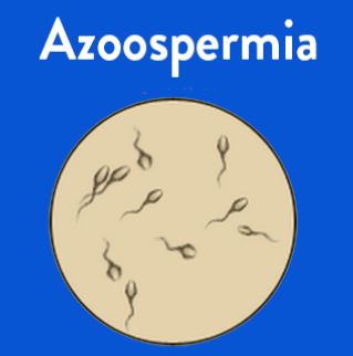 Azoospermia Evaluation